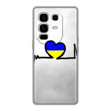 Силіконовий Чохол  на Infinix Note 50 Pro Plus (Я-Україна) (Українська кардіограма)