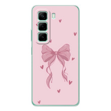 Чохол банти для Infinix Note 50 Pro – Бант на рожевому
