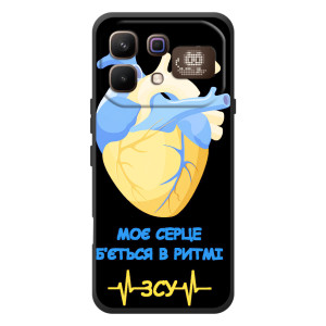 ЗСУ Чехлы (TPU) для Infinix Note 60 Pro (Ритм ЗСУ)