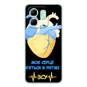 ЗСУ Чехлы (TPU) для Infinix Smart 10 HD (Ритм ЗСУ)