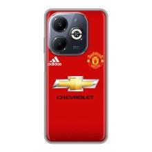 Силіконові Чохли з принтом Футбол на Infinix Smart 8 Plus – Man United