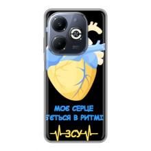 ЗСУ Чехлы (TPU) для Infinix Smart 8 Plus – Ритм ЗСУ