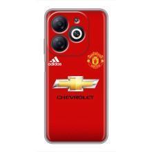 Силиконовые Чехлы принт Футбол на Infinix Smart 8 – Man United