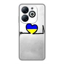 Силиконовый Чехол на Infinix Smart 8 (Я-Украина) – Украинская кардиограмма