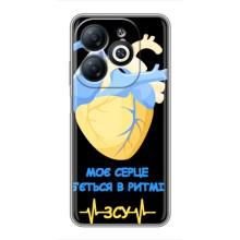 ЗСУ Чохли (TPU) для Infinix Smart 8 – Ритм ЗСУ