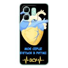 ЗСУ Чехлы (TPU) для Infinix Smart 9 – Ритм ЗСУ