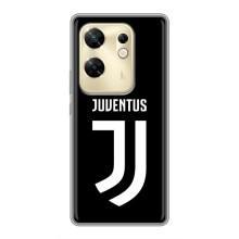 Чехлы для Infinix Zero 30 (VPrint) - Футбольные клубы (ФК Ювентус)