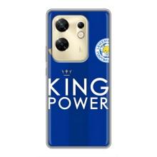 Чехлы для Infinix Zero 30 (VPrint) - Футбольные клубы (Lester)