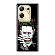 Чехлы с картинкой Джокера на Infinix Zero 30 (Hahaha)