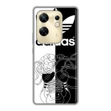 Чехол в стиле "Адидас" для Инфиникс ЗЕРО 30 – Adidas шнурки