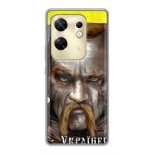 Чехол с картинкой (Патриотический КОЗАК) на Infinix Zero 30 – Одноглазый Козак
