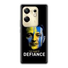 Чехол для Infinix Zero 30 (AlphaPrint - с принтом Зеленского)