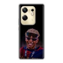 Чохол з футболістом Ламін Ямаль Infinix Zero 30 (Yamal 19)