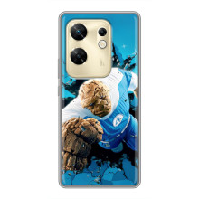 Чохол з принтом Фантастична четвірка для Infinix Zero 30 – Істота