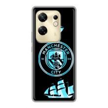 Чехлы для Инфиникс ЗЕРО 30 (VPrint) - ТОП ФК (ФК Манчестер Сити)