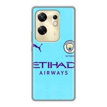 Силіконові Чохли з принтом Футбол на Infinix Zero 30 – Man City