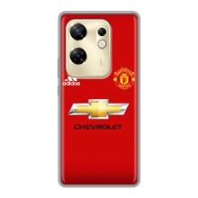 Силіконові Чохли з принтом Футбол на Infinix Zero 30 – Man United