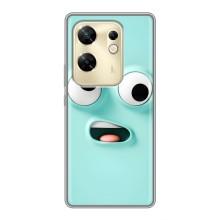 Силиконовые Чехлы (смешные стикеры) для Infinix Zero 30 – мордочка