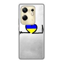 Силиконовый Чехол на Infinix Zero 30 (Я-Украина) – Украинская кардиограмма