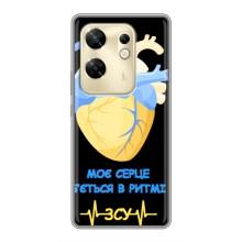 ЗСУ Чохли (TPU) для Infinix Zero 30 – Ритм ЗСУ