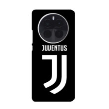 Чохли для Infinix Zero 40 5G (VPrint) - Футбольні клуби (ФК Ювентус)