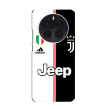 Чохли для Infinix Zero 40 5G (VPrint) - Футбольні клуби (Juventus)