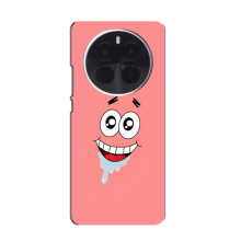 Чехлы с Патриком на Infinix Zero 40 5G (Мордочка Патрика)