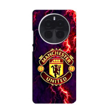 Чохол Манчестер Юнайтед для Іnfіnіx Зеро 40 5G (AlphaPrint) – вогняний Манчестер