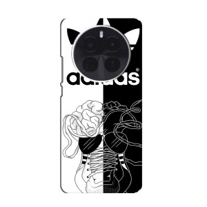 Чохол с стилі "Адідас" для Іnfinix Зіро 40 5G – Adidas шнурки