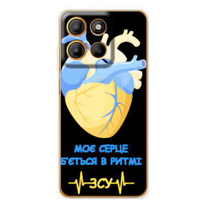 ЗСУ Чехлы (TPU) для Motorola Edge 60 Fusion – Ритм ЗСУ