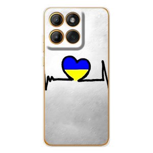 Силиконовый Чехол на Motorola Edge 60 Pro (Я-Украина) – Украинская кардиограмма