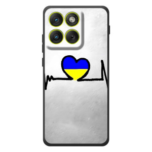 Силиконовый Чехол на Motorola Edge 70 (Я-Украина) – Украинская кардиограмма