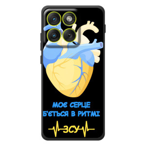 ЗСУ Чехлы (TPU) для Motorola Edge 70 – Ритм ЗСУ