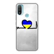 Силіконовий Чохол  на Motorola MOTO E20 (Я-Україна) (Українська кардіограма)
