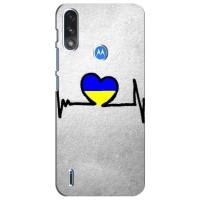 Силіконовий Чохол  на Motorola Moto E7i / E7 Power (Я-Україна) (Українська кардіограма)