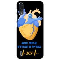 ЗСУ Чохли (TPU) для Motorola Moto E7i / E7 Power (Ритм ЗСУ)
