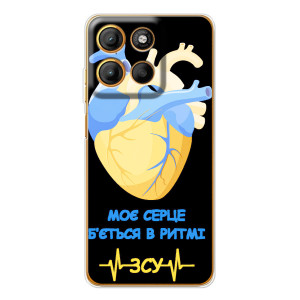 ЗСУ Чохли (TPU) для Motorola Moto G15 Power – Ритм ЗСУ