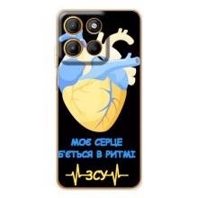ЗСУ Чехлы (TPU) для Motorola MOTO G56 (Ритм ЗСУ)