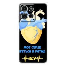 ЗСУ Чохли (TPU) для Motorola Moto G75 – Ритм ЗСУ