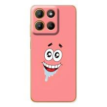 Чехлы с Патриком на Motorola MOTO G86 Power (Мордочка Патрика)
