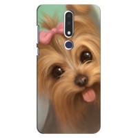 Чехол (ТПУ) Милые собачки для Nokia 3.1 Plus, 3 Plus 2018 – Йоршенский терьер