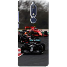 Чехол Формула1 на Nokia 5 2018, 5.1 – Гонка Ф1
