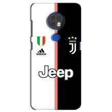 Чохли для Nokia 6.2 (2019) (VPrint) - Футбольні клуби (Juventus)