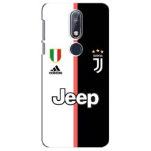 Чехлы с ТОП Футбольными клубами на Nokia 7 2018, 7.1 (Juventus)