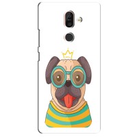 Бампер для Nokia 7 Plus с картинкой "Песики" – Собака Король