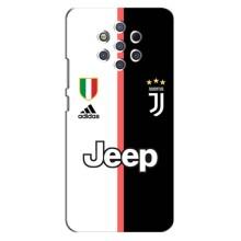 Чохоли з ТОР футбольними клубами на Nokia 9 (Juventus)