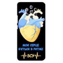 ЗСУ Чохли (TPU) для Nokia 9 (Ритм ЗСУ)