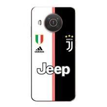 Чехлы для Nokia X10 (VPrint) - Футбольные клубы (Juventus)