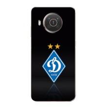 Чохли для Nokia X20 (VPrint) - Футбольні клуби