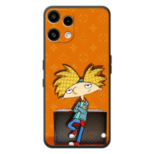 Брендновые Чехлы для Nothing Phone (3a) Lite - (PREMIUMPrint) (Арнольд)